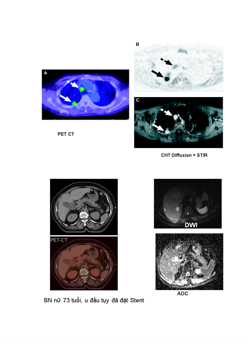 image for page Nguyên lý trọng khuyếch tán