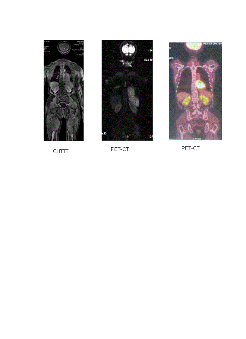 image for page Nguyên lý trọng khuyếch tán
