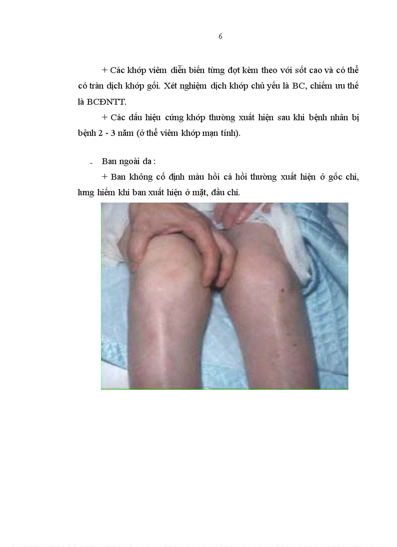 image for page Nghiên cứu đặc điểm lâm sàng cận lâm sàng của bệnh Still ở người lớn