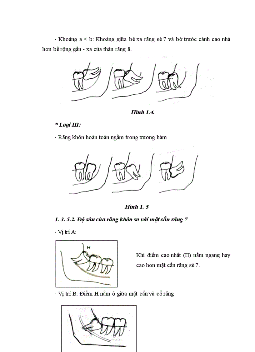 image for page Nhận xét đặc điểm lâm sàng X quang và đánh giá kết quả phẫu thuật RKHD mọc lệch mọc ngầm dưới gây mê nội khí quản