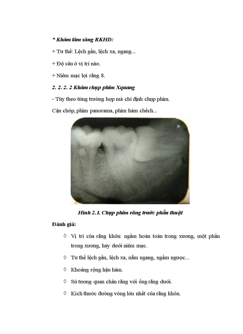 image for page Nhận xét đặc điểm lâm sàng X quang và đánh giá kết quả phẫu thuật RKHD mọc lệch mọc ngầm dưới gây mê nội khí quản