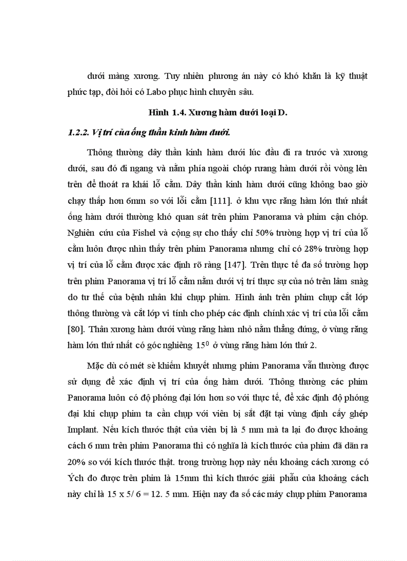 image for page Điều trị mất răng hàm lớn bằng phục hình Implant