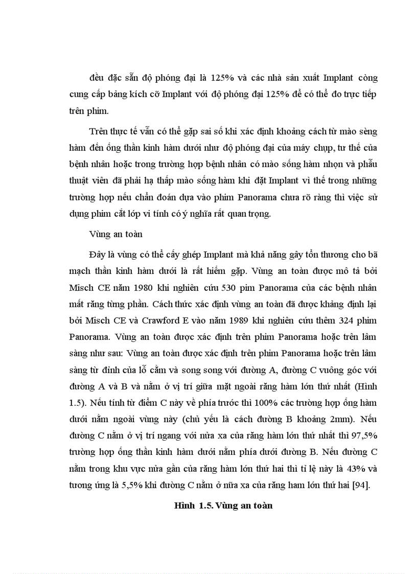 image for page Điều trị mất răng hàm lớn bằng phục hình Implant