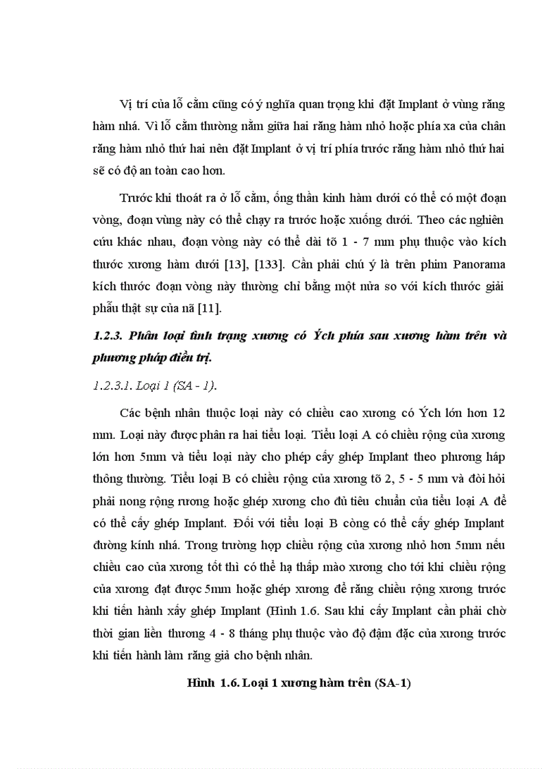 image for page Điều trị mất răng hàm lớn bằng phục hình Implant