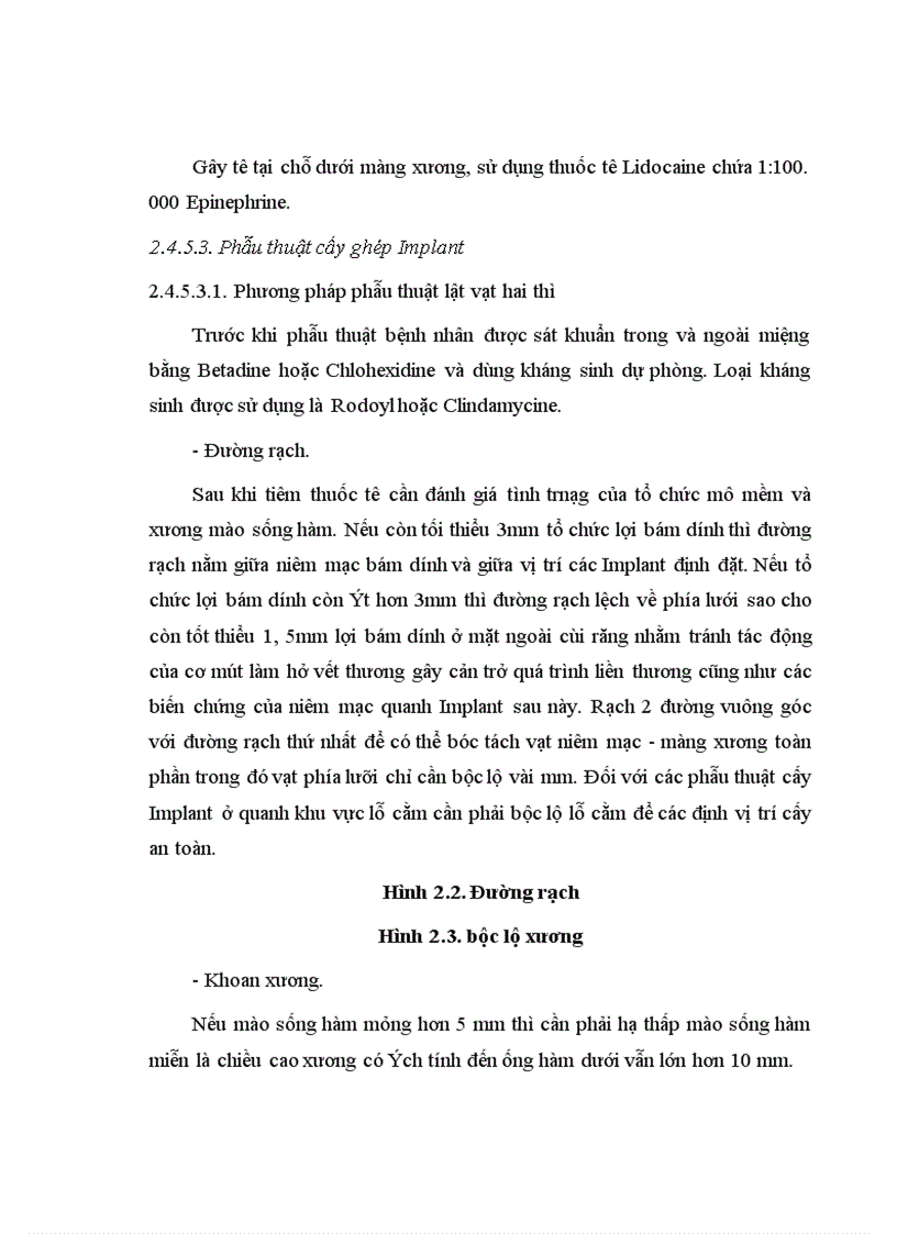 image for page Điều trị mất răng hàm lớn bằng phục hình Implant