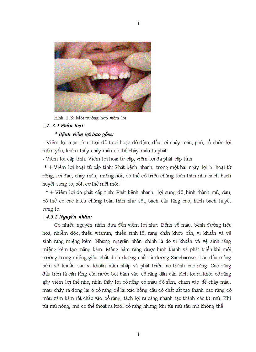 image for page Thực trạng bệnh răng miệng và các yếu tố liên quan của học sinh trường tiểu học Tam Hiệp Thanh Trì Hà Nội năm 2009 1