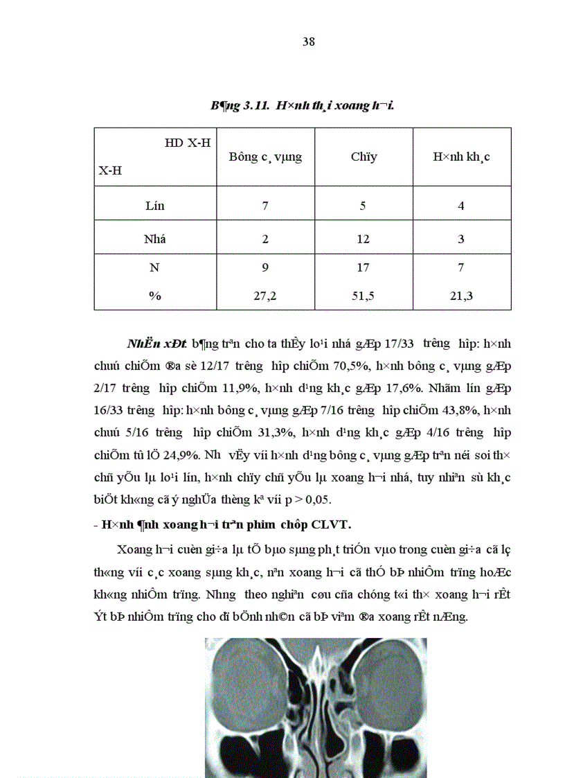 image for page Nghiên cứu hình thái lâm sàng của dị hình cuốn mũi giữa trong bệnh lý mũi xoang qua nội soi và chụp cắt lớp vi tính