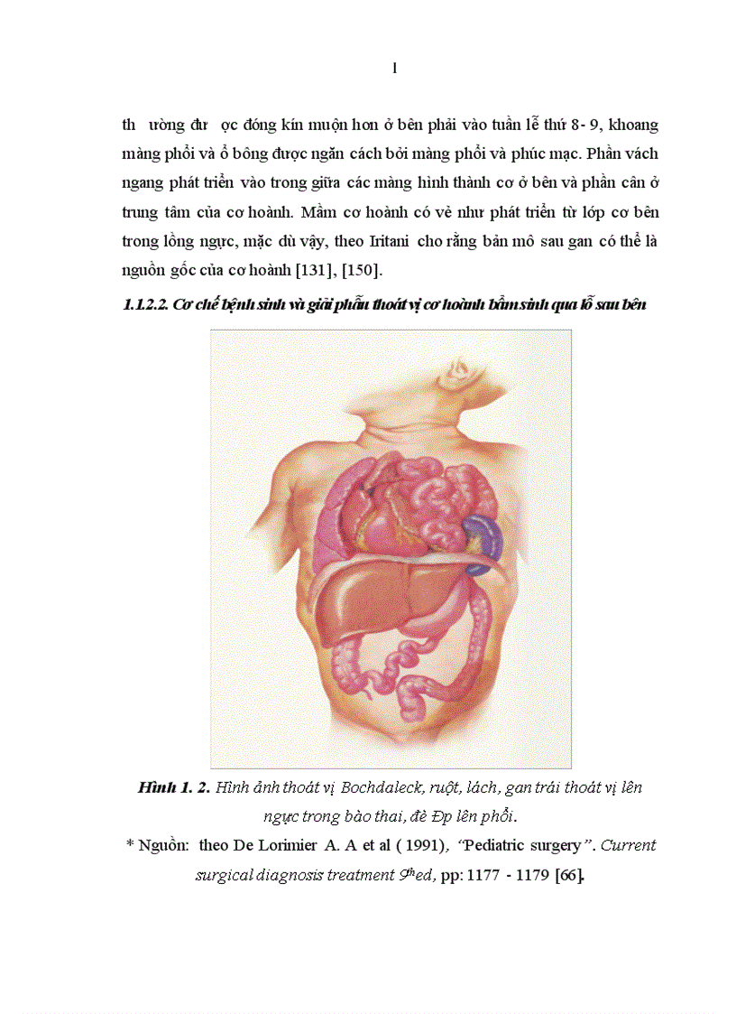 image for page Nghiên cứu một số đặc điểm lâm sàng cận lâm sàng bệnh thoát vị cơ hoành bẩm sinh qua lỗ sau bên ở trẻ em 1
