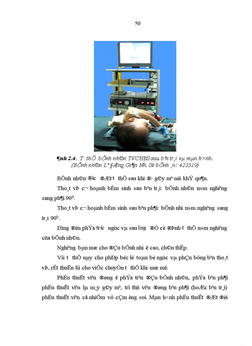 image for page Nghiên cứu một số đặc điểm lâm sàng cận lâm sàng bệnh thoát vị cơ hoành bẩm sinh qua lỗ sau bên ở trẻ em 1