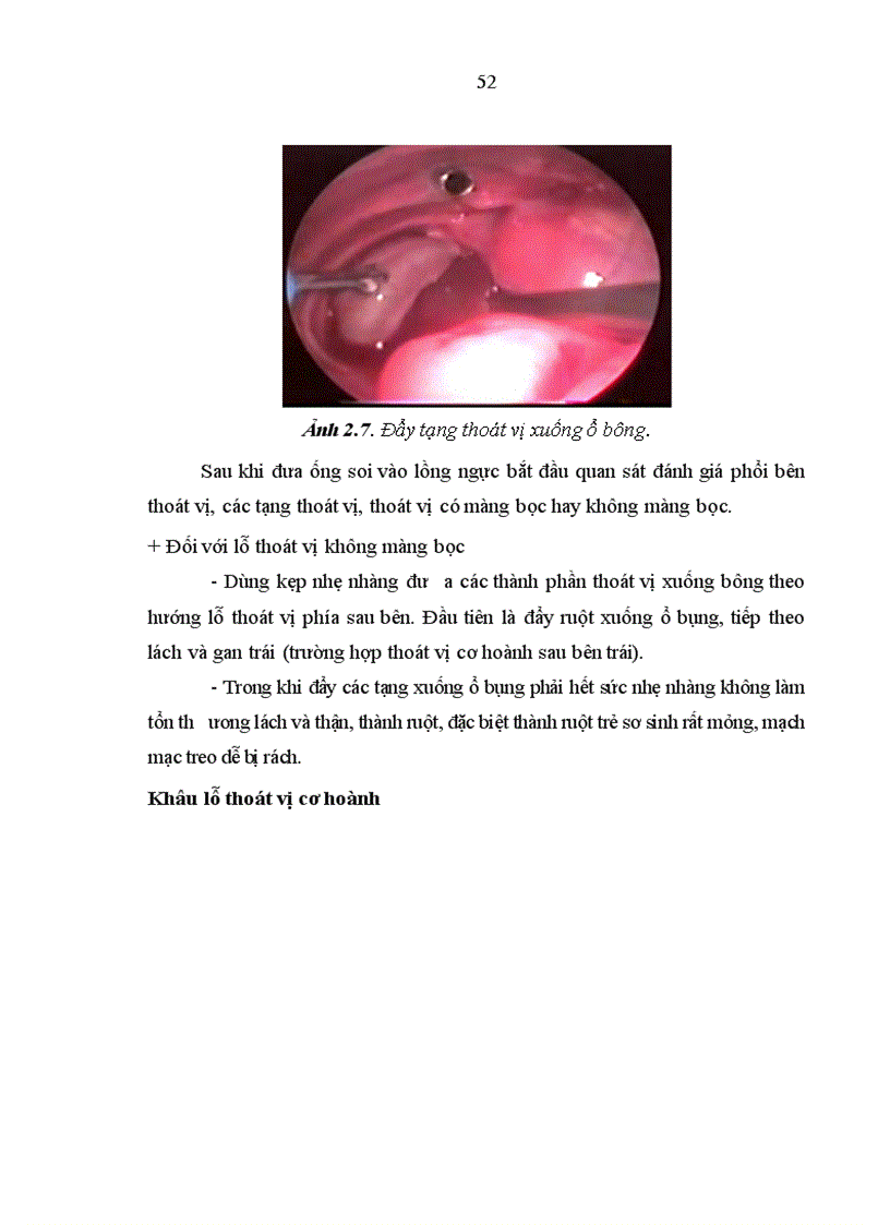 image for page Nghiên cứu một số đặc điểm lâm sàng cận lâm sàng bệnh thoát vị cơ hoành bẩm sinh qua lỗ sau bên ở trẻ em 1