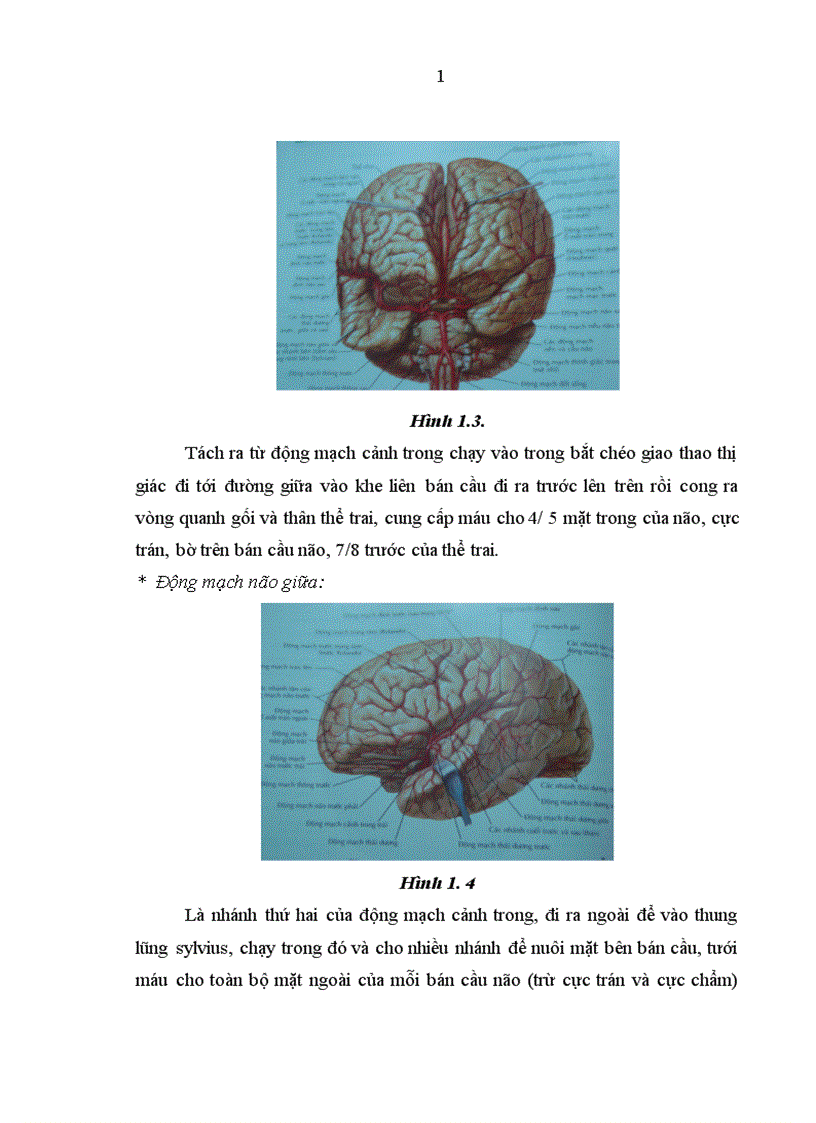 image for page Nghiên cứu đặc điểm hình ảnh và giá trị của chụp cắt lớp vi tính trong chẩn đoán xuất huyết não do tai biến mạch máu não