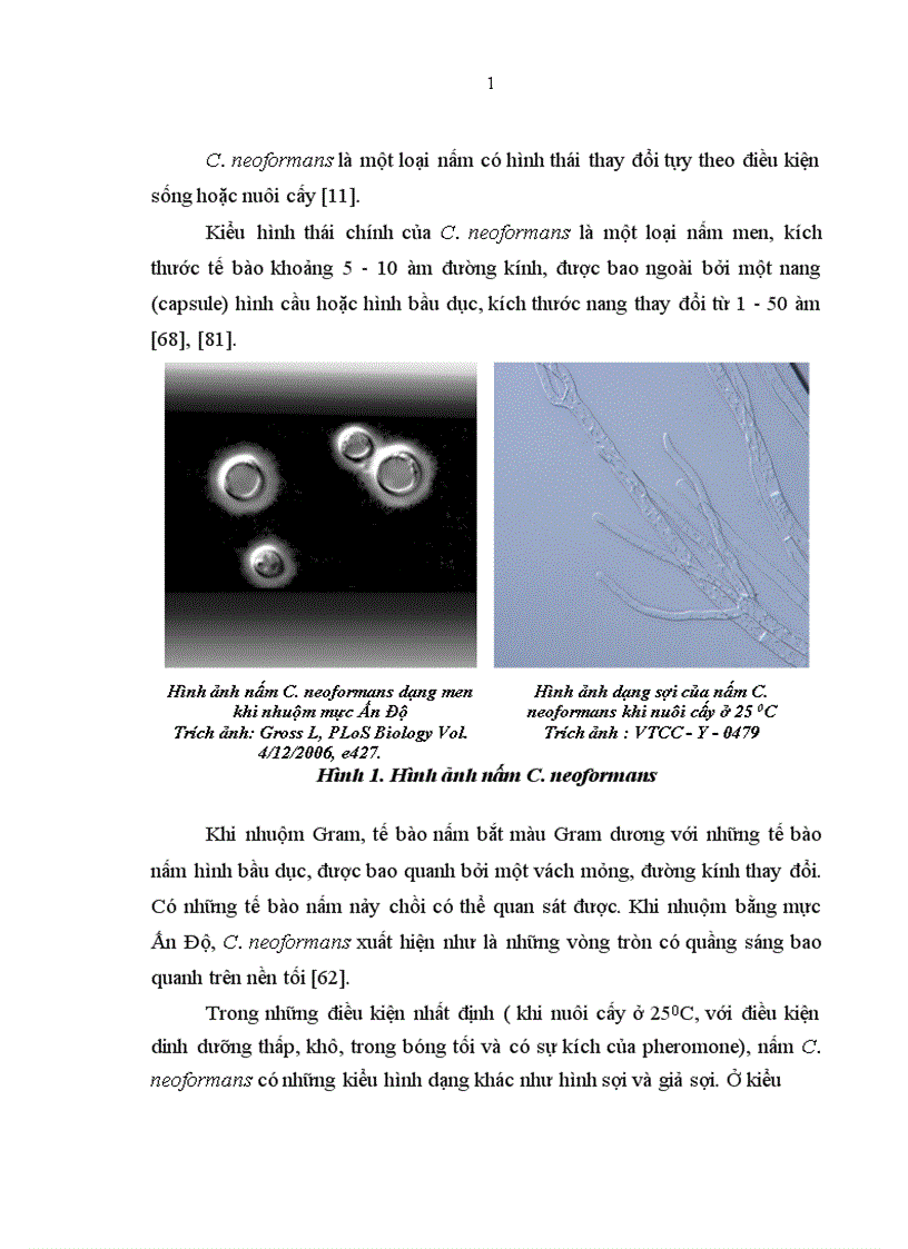 image for page Nghiên cứu đặc điểm lâm sàng cận lâm sàng của viêm màng não do nấm Cryptococcus neoformans ở bệnh nhân HIV AIDS 1