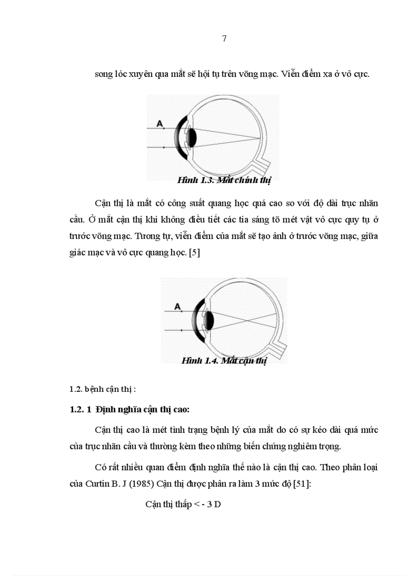 image for page Nghiên cứu đặc điểm lâm sàng cận lâm sàng của bệnh cận thị người trưởng thành và kết quả điều trị bằng phương pháp tán nhuyễn thể thủy tinh
