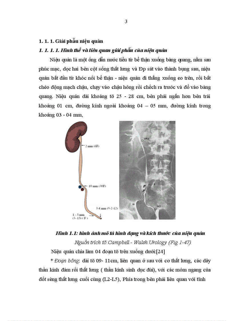 image for page Nghiên cứu điều trị sỏi niệu quản bằng phương pháp tán sỏi nội soi ngược dòng trên máy Lithoclast tại bệnh viện Thanh Nhàn