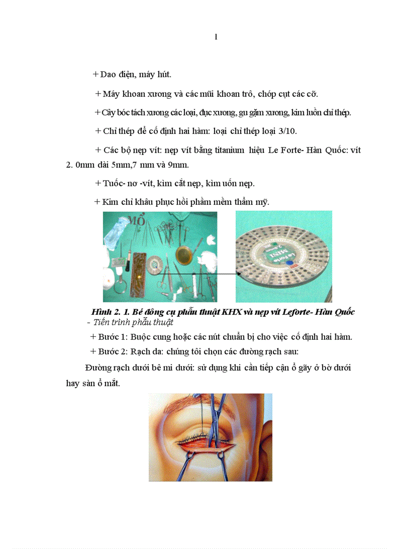 image for page Nghiên cứu các hình thái lâm sàng của chấn thương tầng giữa khối mặt và đánh giá kết quả xử trí với phương pháp KHX bằng nẹp vít