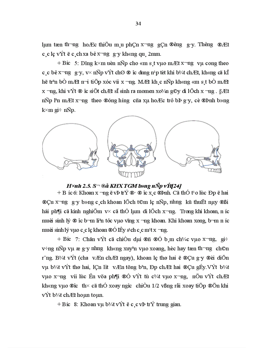 image for page Nghiên cứu các hình thái lâm sàng của chấn thương tầng giữa khối mặt và đánh giá kết quả xử trí với phương pháp KHX bằng nẹp vít