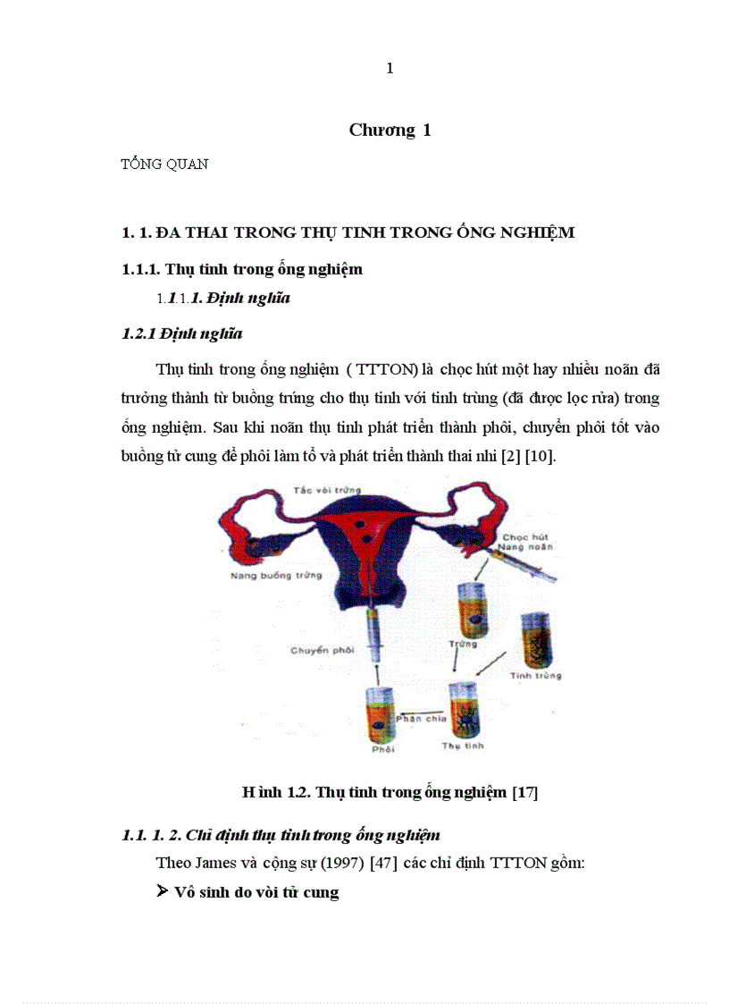 image for page Đánh giá kết quả giảm thiểu phôi chọn lọc tại Bệnh viện Phụ sản Trung ương từ 01 01 2004 đến 31 12 2008 1