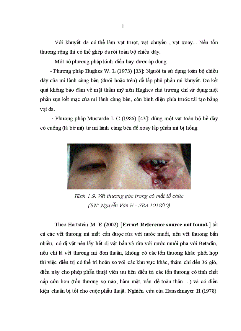 image for page Nghiên cứu đặc điểm lâm sàng tổn thương góc trong mắt do chấn thương và kết quả điều trị