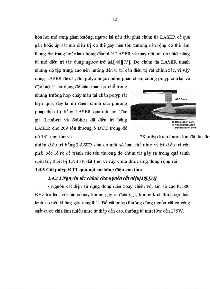 image for page Nhận xét hình ảnh nội soi mô bệnh học của polyp đại trực tràng và kết quả cắt polyp bằng nguồn cắt ENDOPLASMA