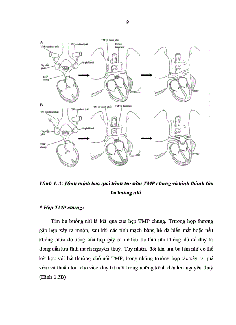 image for page Nghiên cứu đặc điểm lâm sàng cận lâm sàng bệnh tĩnh mạch phổi về lạc chỗ hoàn toàn ở trẻ em