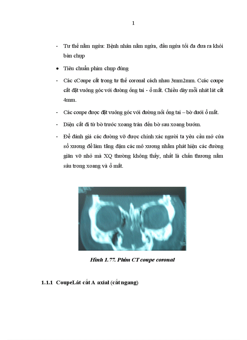 image for page Nghiên cứu đặc điểm lâm sàng và chụp cắt lớp vi của chấn thương tháp mũi
