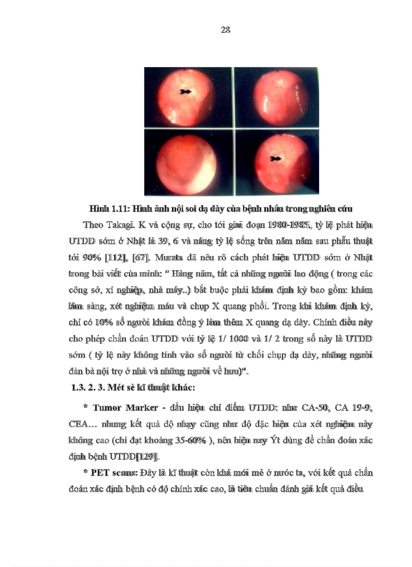 image for page Đánh giá kết quả điều trị bệnh UTDD bằng phẫu thuật triệt căn và hoá trị bổ trợ tại khoa ngoại bệnh viện Việt Tiệp Hải Phòng từ 2001 đến 2007