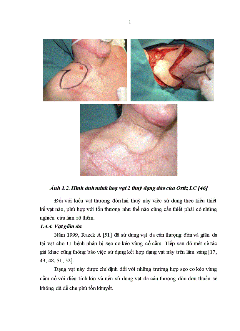 image for page Nghiên cứu đặc điểm giải phẫu và ứng dụng vạt da cân thượng đòn trong phẫu thuật tạo hình 1