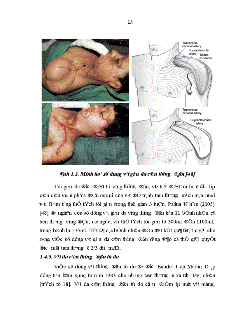 image for page Nghiên cứu đặc điểm giải phẫu và ứng dụng vạt da cân thượng đòn trong phẫu thuật tạo hình 1