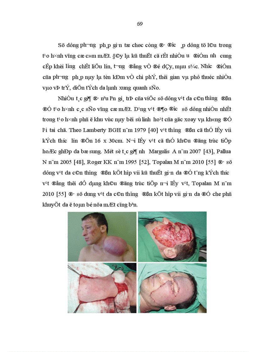 image for page Nghiên cứu đặc điểm giải phẫu và ứng dụng vạt da cân thượng đòn trong phẫu thuật tạo hình 1