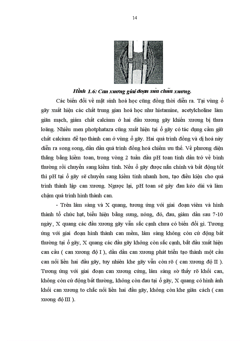 image for page Đa nh gia kê t qua điê u tri châ m liê n xương va khơ p gia hai xương că ng tay ơ ngươ i lơ n bă ng phương pha p kê t hơ p xương ne p vi t vơ i ghe p xương ma o châ u tư thân