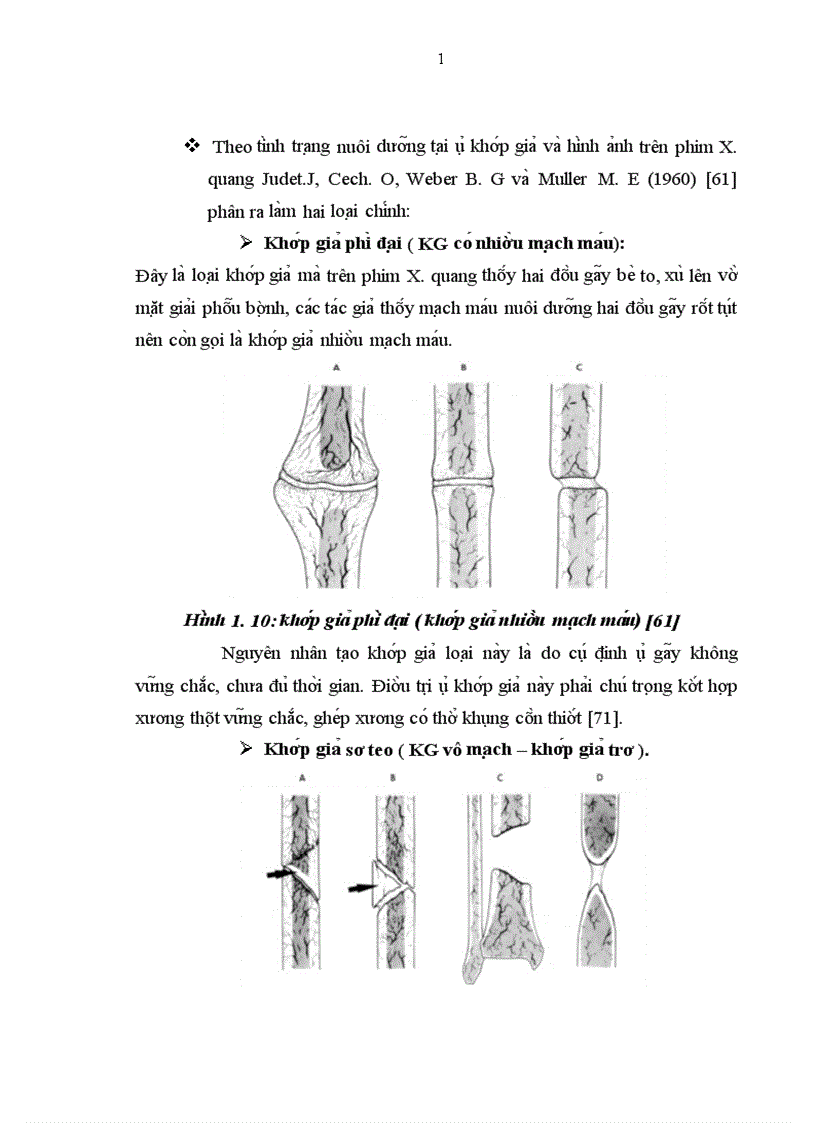 image for page Đa nh gia kê t qua điê u tri châ m liê n xương va khơ p gia hai xương că ng tay ơ ngươ i lơ n bă ng phương pha p kê t hơ p xương ne p vi t vơ i ghe p xương ma o châ u tư thân