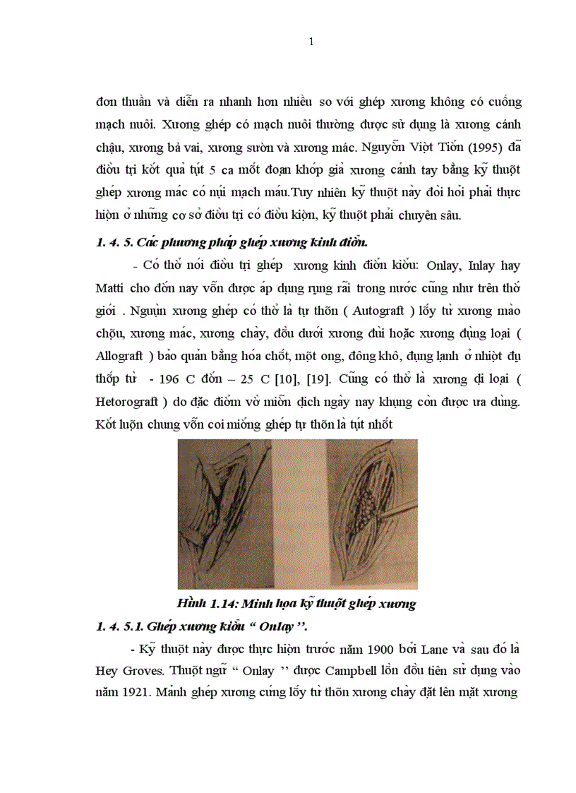 image for page Đa nh gia kê t qua điê u tri châ m liê n xương va khơ p gia hai xương că ng tay ơ ngươ i lơ n bă ng phương pha p kê t hơ p xương ne p vi t vơ i ghe p xương ma o châ u tư thân