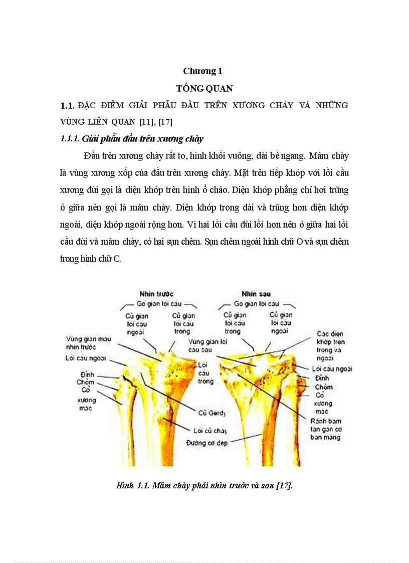 Đánh giá kết quả điều trị gãy kín mâm chày do chấn thương bằng phương pháp kết hợp xương nẹp vít tại Viện CTCH Bệnh viện TƯQĐ 108