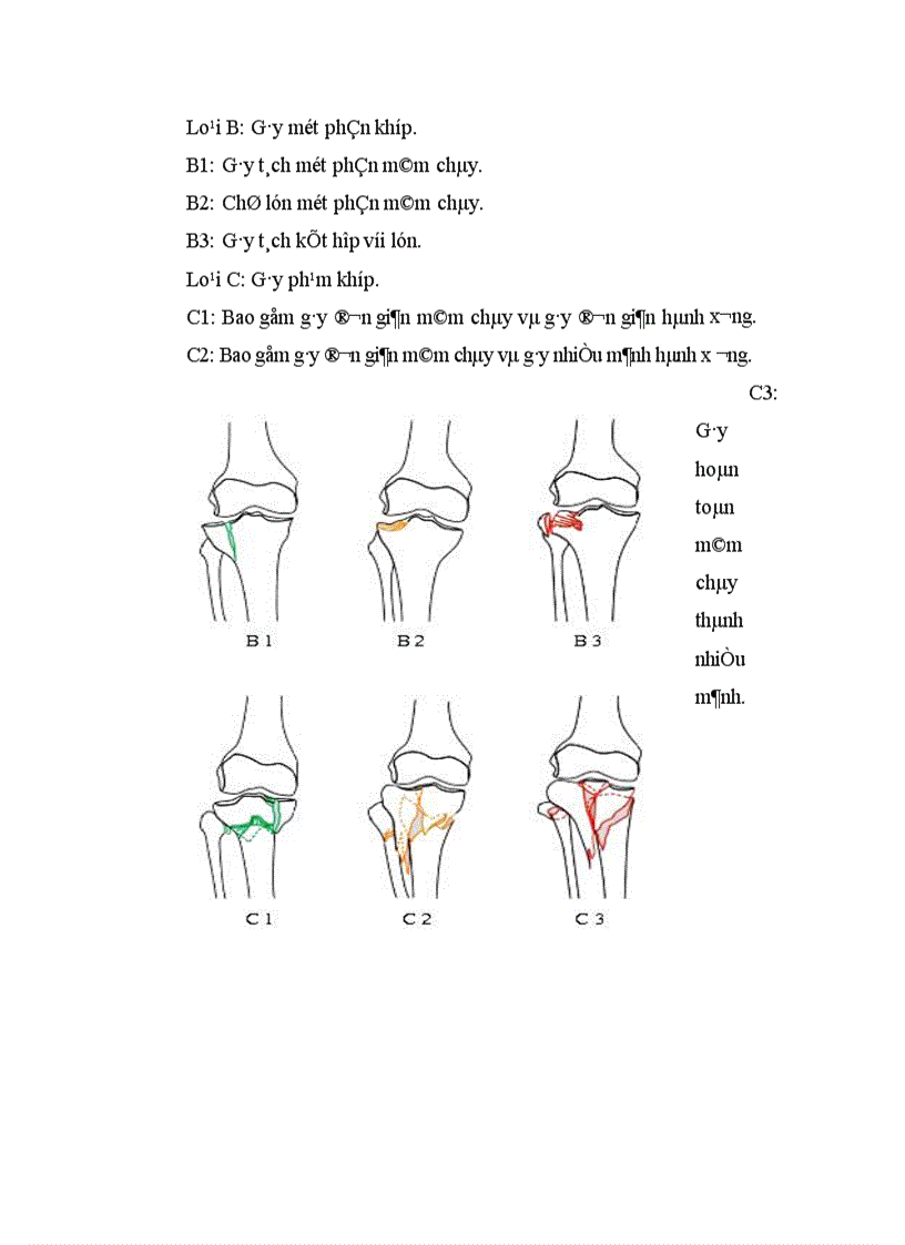 image for page Đánh giá kết quả điều trị gãy kín mâm chày do chấn thương bằng phương pháp kết hợp xương nẹp vít tại Viện CTCH Bệnh viện TƯQĐ 108