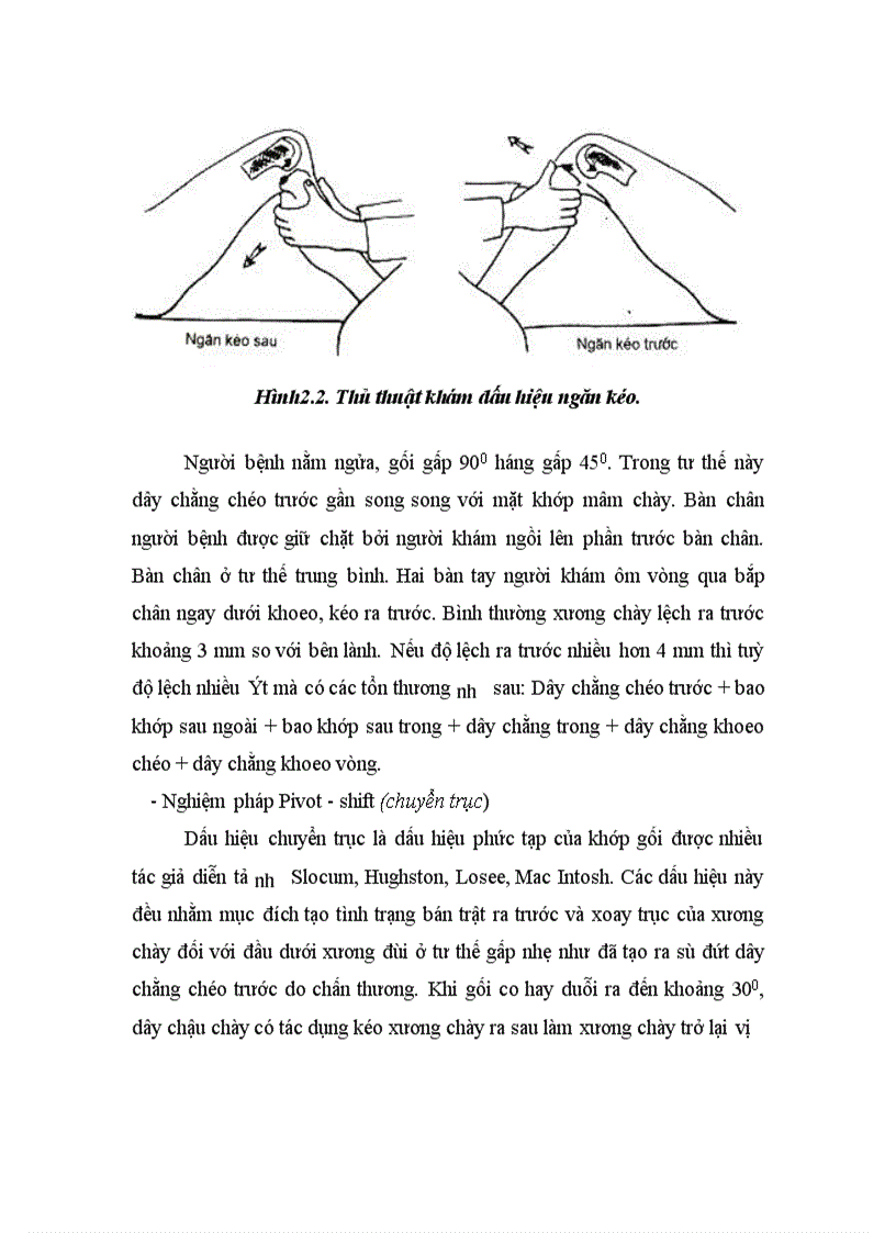 image for page Đánh giá kết quả điều trị gãy kín mâm chày do chấn thương bằng phương pháp kết hợp xương nẹp vít tại Viện CTCH Bệnh viện TƯQĐ 108