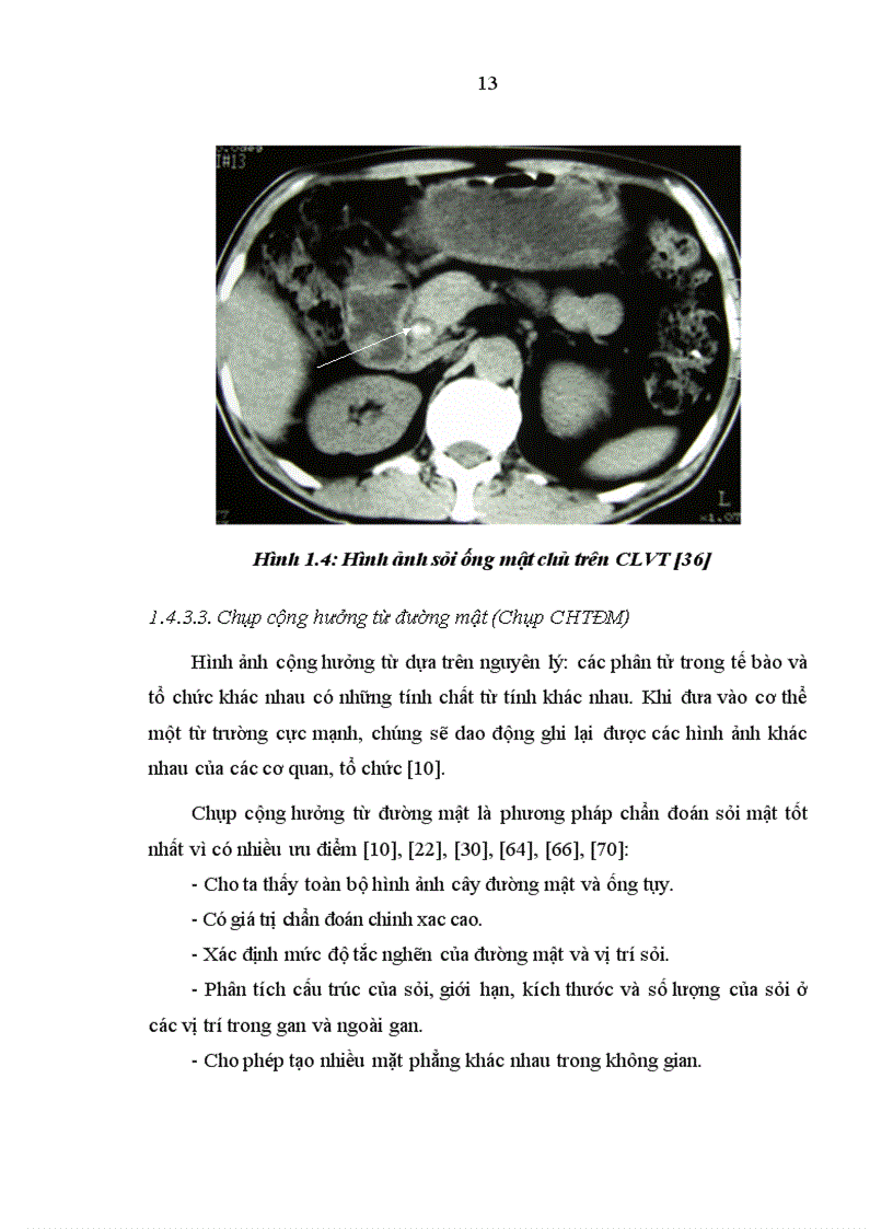 image for page Đánh giá kết quả của phương pháp phẫu thuật khâu kín ống mật chủ sau khi lấy sỏi để điều trị sỏi đường mật chính ngoài gan 1