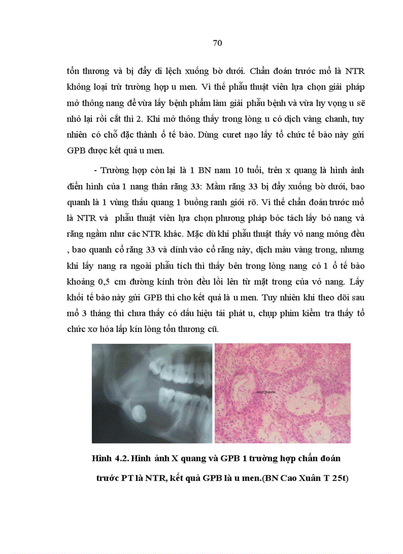 image for page Nhận xét lâm sàng hình ảnh X quang giải phẫu bệnh và đánh giá kết quả phẫu thuật nang thân răng