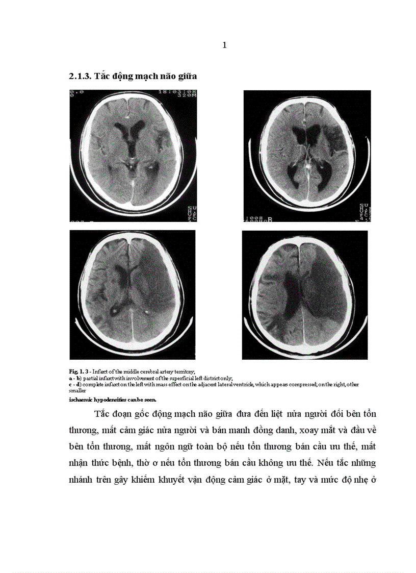 image for page Bệnh học thần kinh