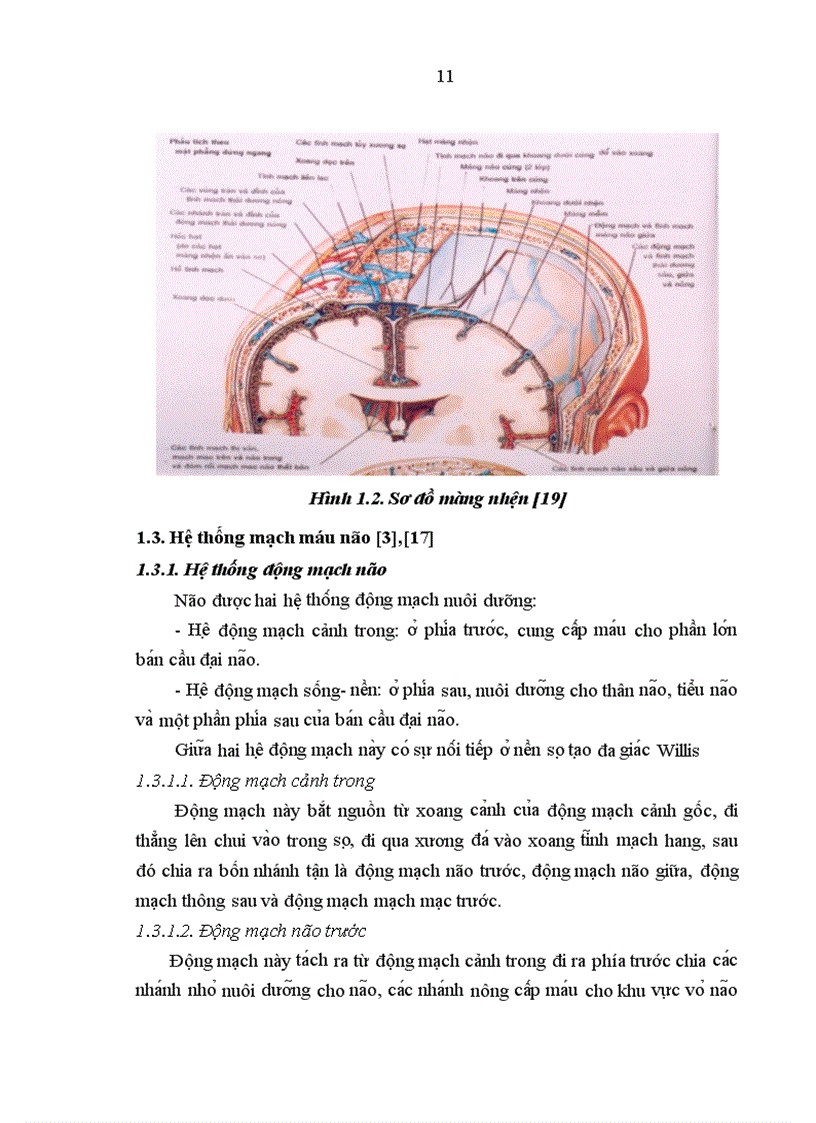 image for page Nghiên cứu đặc điểm lâm sàng hình ảnh học và một số biến chứng của bệnh nhân chảy máu dưới nhện do vỡ phình động mạch thông trước 1