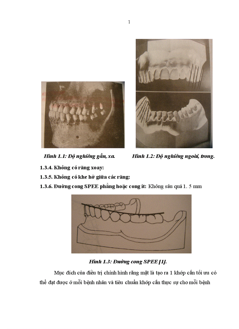image for page Nhận xét mối liên quan giữa thói quen răng miệng xấu và lệch lạc khớp cắn ở trẻ em lứa tuổi 7 11 tại Trường tiểu học Tân Mai Hà Nội 1