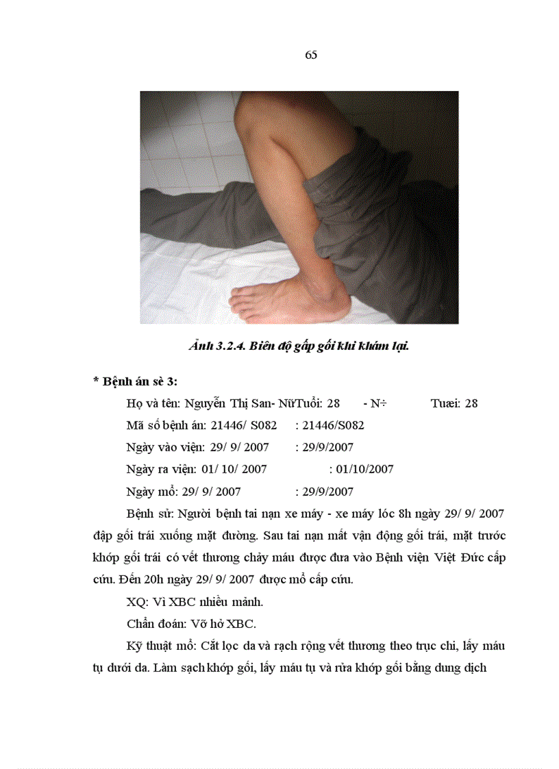 image for page Đánh giá kết quả phẫu thuật vỡ xương bánh chè tại Bệnh viện Việt Đức từ tháng 1 2006 đến 12 2007