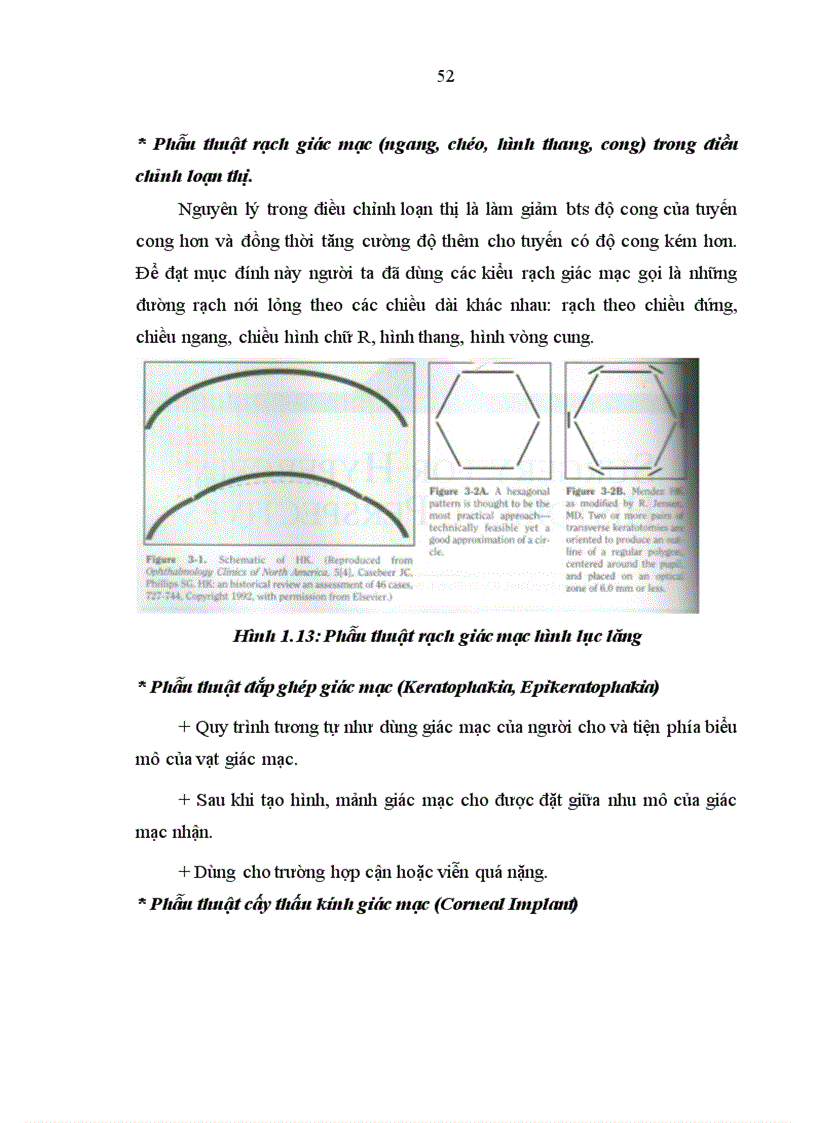 image for page Nghiên cứu đặc điểm lâm sàng và điều trị nhược thị do tật khúc xạ ở trẻ em