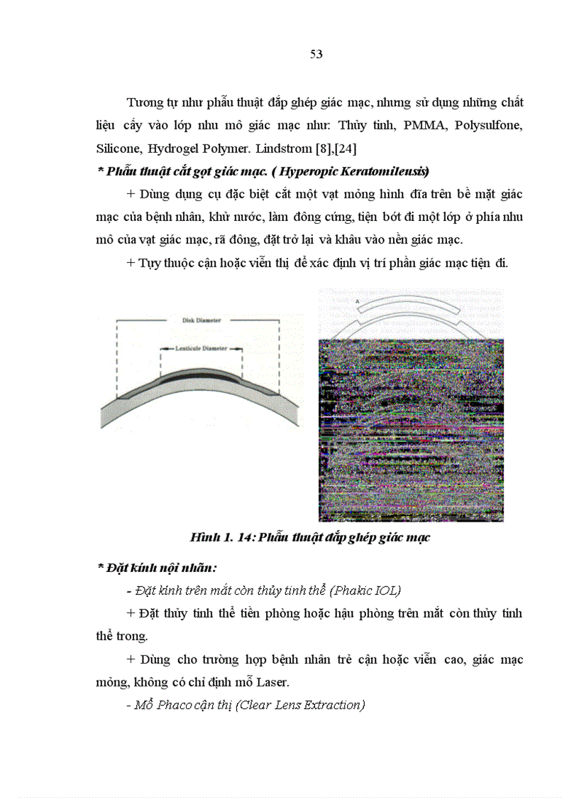 image for page Nghiên cứu đặc điểm lâm sàng và điều trị nhược thị do tật khúc xạ ở trẻ em