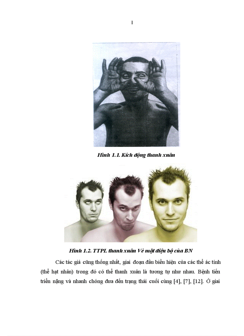 image for page Nghiên cứu đặc điểm lâm sàng ở bệnh nhân tâm thần phân liệt thể thanh xuân 1