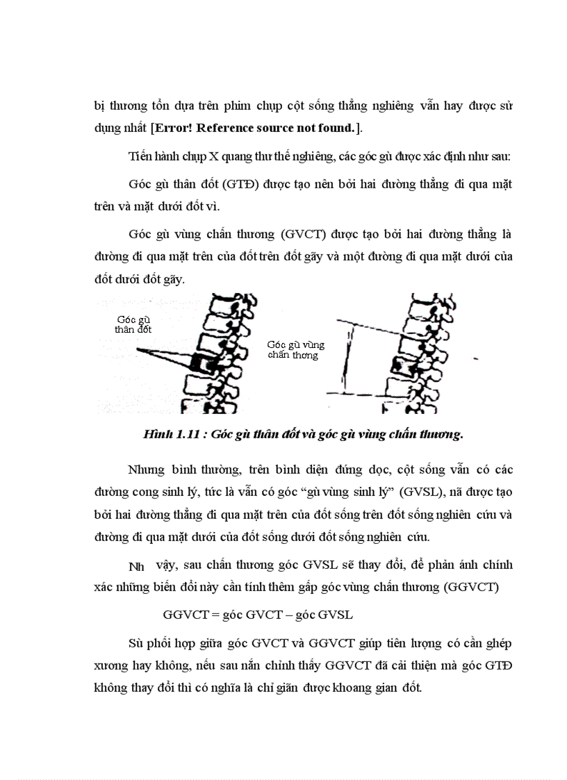 image for page Đánh giá kết quả điều trị phẫu thuật chấn thương cột sống ngực bằng phương pháp bắt vít qua cuống tại Bệnh viện Việt Đức 1
