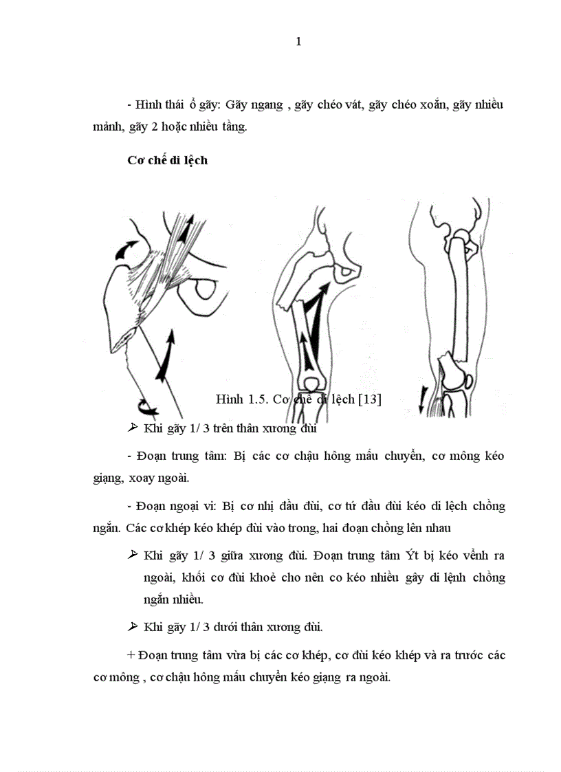 image for page Đánh giá kết quả điều trị gãy kín thân xương đùi ở người lớn bằng nẹp vít tại bệnh viện Việt Đức trong 2 năm 2004 2005 1