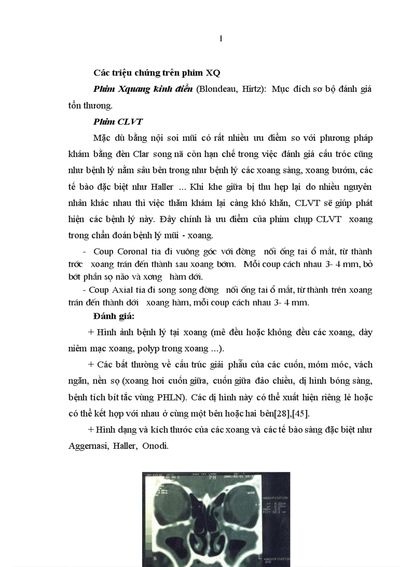 image for page Nghiên cứu đặc điểm lâm sàng cận lâm sàng của viêm xoang nhiễm khuẩn ở trẻ em 1