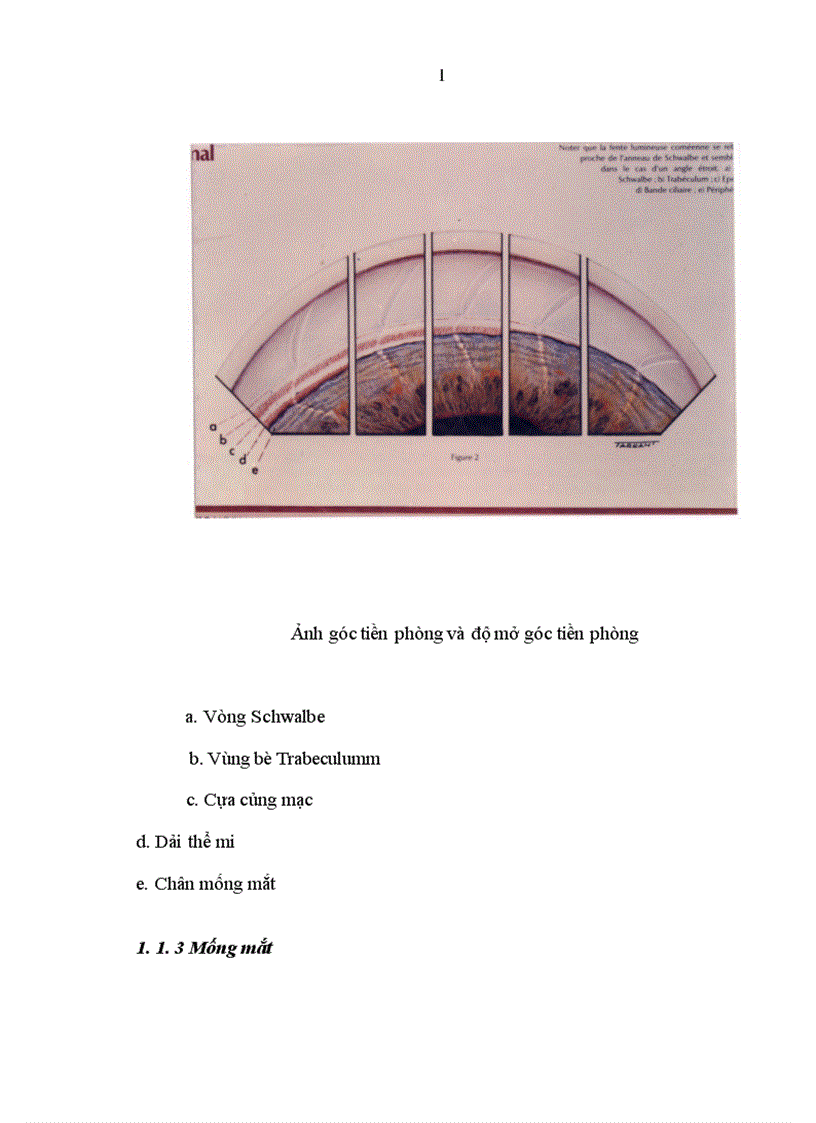 image for page Nghiên cứu đặc điểm lâm sàng và kết quả điều trị của biến chứng xẹp tiền phòng sau phẫu thuật Glôcôm