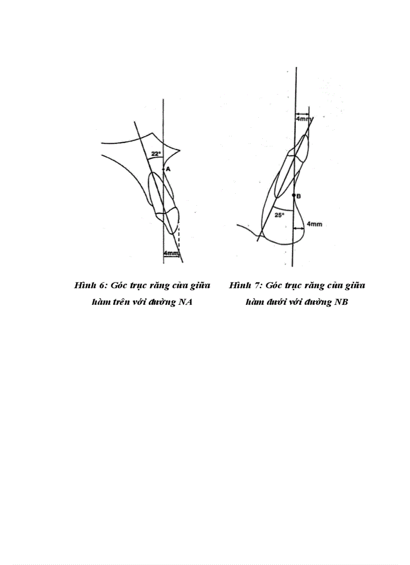 image for page Nghiên cứu điều trị một số biến dạng xương hàm bằng phẫu thuật 1