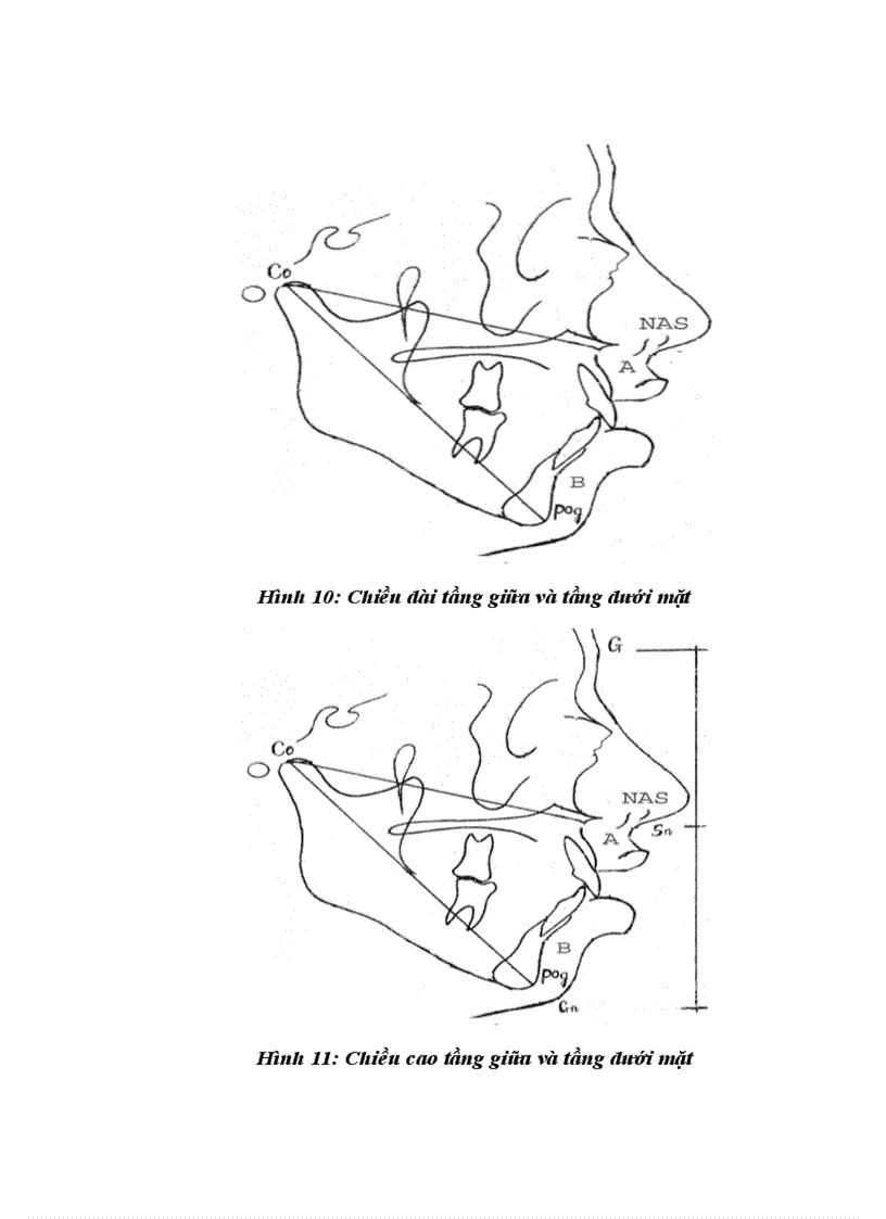 image for page Nghiên cứu điều trị một số biến dạng xương hàm bằng phẫu thuật 1